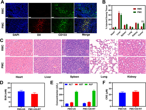 Figure 3 Result of in vivo safety experiments. (A) Colocalization of Dil (red), CD133 antibody-labelled cancer cells (green) and nucleus (blue) in tumor sections of 4T1 tumor-bearing mice 12 h after intravenous administration of indicated nanoparticles. Scale bars: 50 μm. (B) Biodistribution profile of Mn element in the main organs and tumor tissues at 12-h post-injection with different nanoparticles. (C) Histopathological analysis results of (H&E) stained images of the major organs (heart, lung, liver, kidneys, and spleen) of mice that were exposed to different treatments 16 days post-injection under laser irradiation. Scale bars: 100 μm. Blood biochemistry data including kidney function markers and liver function markers: (D) BUN, (E) ALT, AST and ALP, and (F) CRE after various treatments. ***P < 0.001; Student’s t-test.