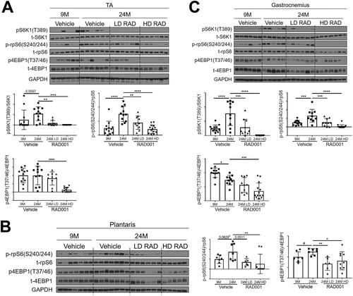 FIG 2 Confirmed mTORC1 inhibition following rapalog treatment. Representative immunoblots are shown for phosphorylated (p) and total (t) protein for S6K1, rpS6, and 4EBP1 in tibialis anterior (A), plantaris (B), and gastrocnemius (C) muscles of 9- and 24-month-old rats treated with vehicle and of 24-month-old rats treated with 0.15 mg/kg (LD) or 0.5 mg/kg (HD) RAD001. Glyceraldehyde-3-phosphate dehydrogenase (GAPDH) is shown as a protein loading control. p-S6K1(T389), p-rpS6(S240/244), and p4EBP1(T37/46) protein amounts were quantified relative to the respective total S6K1, rpS6, and 4EBP1 protein amounts by densitometry (n = 10 to 12 animals per group). Data are means ± standard deviations of the means. y-axis data represent arbitrary units. Asterisks are used to denote significance as follows: *, P < 0.05; **, P < 0.01; ***, P < 0.001; ****, P < 0.0001. Pound signs are used to denote significance as follows: #, P < 0.05 (by unpaired Student's t test).