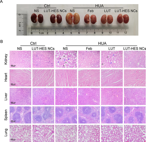 Figure 11 Representative external photos of kidney (A) and representative histopathological images of organs (kidney, heart, liver, spleen and lung) (B) from mice with different treatment.