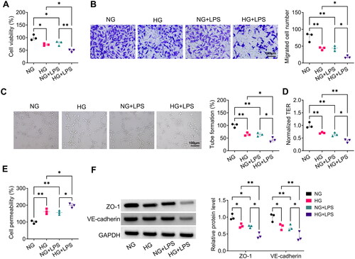 Figure 1. LPS exacerbated HG-induced dysfunction in HPMECs. HPMECs were induced with HG and LPS for 24 h. CCK8 (A), transwell assay (B), tube formation assay (C) and TER assay (D) were used to test cell viability, migration, angiogenesis and TER. (E) FITC-dextran assay for the determination of cell permeability. (F) The protein levels of ZO-1 and VE-cadherin were measured by WB analysis. *p < 0.05; **p < 0.01.