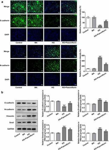 Figure 2. Pae inhibited EMT in SRA01/04 cells induced by HG. a. IF detected the expression of E-cadherin and N-cadherin. b. Western blot detected the expression of EMT-related proteins. ***p < 0.001 vs MA, ##p < 0.01, ###p < 0.001 vs HG.