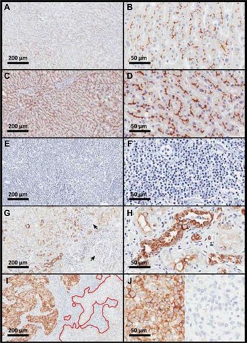 Figure 2 Immunohistochemical evaluation of ABCB1 in human tissues.
