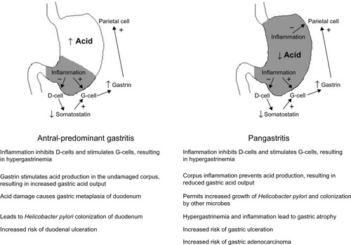 Figure 1 The effect of gastritis pattern on gastric acid production and associations with duodenal and gastric disease.