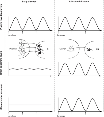 Figure 4 The evolution of levodopa-associated motor fluctuations. A comparison of plasma levodopa levels, brain dopamine levels, and the resulting motor response in early and advanced stages of Parkinson’s disease is shown.