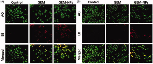 Figure 5. Dual AO/EB fluorescent staining of B-CPAP and FTC-133 thyroid cancer cell lines after treatment with GEM and GEM-NPs (IC50 concentration) for 24 h.