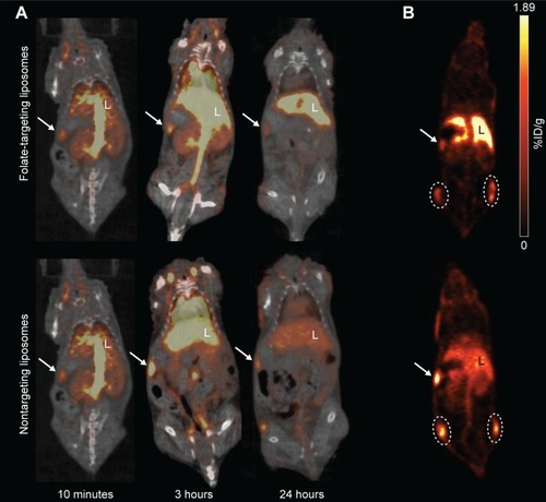 Figure 3 PET/CT of FTLs and NTLs in tumor-bearing mice.Notes: (A) 64Cu-liposome PET/CT images of 64Cu-FTLs 10 minutes, 3 hours, and 24 hours pi. (top images) and 64Cu-NTLs 10 minutes, 3 hours, and 24 hours pi. (bottom images). Liver (L), spleen (arrow). (B) 64Cu-liposome PET images 24 hours pi. of tumor uptake of 64Cu-FTLs (top image) and 64Cu-NTLs (bottom image). Left and right flank tumors are encircled in white, liver (L), spleen (arrow).Abbreviations: FTL, folate-targeting liposomes; NTL, nontargeting liposomes; PET/CT, positron emission tomography/computed tomography.