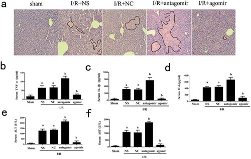 Figure 4. Effects of miR-125b on liver tissue treated by I/R. (a) H&E staining of liver tissue, the original magnification = 200 × . Histopathological changes of liver were marked by black line. (b-d) Serum TNF-α, IL-1β and IL-6 levels. (e-f) Serum level of ALT and AST. Mice were injected with miR-125b agomir, negative control, antagomir or normal saline 1 h prior to I/R treatment. aP < 0.05 compared with Ctrl groups. bP < 0.05 compared with NC groups.