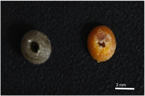 Figure 18 Comparison between gentamicin-laden and methotrexate-laden beads. Left image represents a gentamicin-laden bead and the right image represents a methotrexate-laden bead.