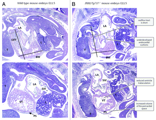 Figure 3. Defects in ciliogenesis lead to CHD in Ift88/Tg737−/− mouse embryos (E11.5). Upper panels: longitudinal mid-sagittal sections. Lower panels: comparable longitudinal para-sagittal sections. Abbreviations: BW, body wall; L, liver; LA, left atrium; OFT, outflow tract; PS, pericardial space (arrow); SiV, sinus venosus; T, tongue; VT, ventricle. The black bars have identical dimensions in wt (A) and mutant (B) embryos. The distal end of the OFT is marked with a dotted line. The Figure is modified from ref. Citation21 with permission.