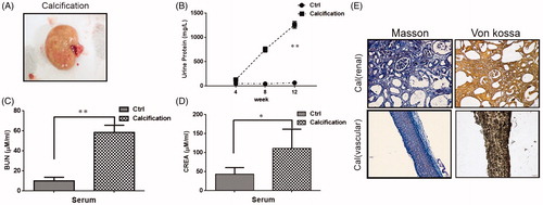 Figure 4. Renal pathological parameters in calcified rats. (A) Renal phenotype of calcified rats. It showed renal hypertrophy, pale color and uneven surface. (B) Comparison of urine protein between calcified rats and normal rats. The urine protein of the calcified group was significantly higher than that in the normal group. With the extension of modeling time, the change is more obvious. (C) Comparison of serum urea nitrogen between calcified rats and normal rats. The serum urea nitrogen concentration in the calcified group was significantly higher than that in the normal group, and the difference was statistically significant. (D) Comparison of serum creatinine between calcified rats and normal rats. The serum creatinine concentration in the calcified group was significantly higher than that in the normal group, and the difference was statistically significant. (E) The calcium deposition of renal and vascular. Masson staining showed a large amount of deposits in renal interstitial tissue calcified aorta (it indicates collagen hyperplasia). The von Kossa staining showed a large amount of black particle deposits in the renal interstitial tissue and calcified aorta (black deposits indicate calcium deposition).