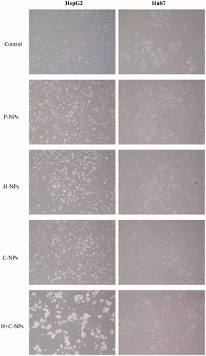 Figure 5. Phase-contrast photomicrographs of HepG2 and Huh7cells following a 24 h treatment with P-NPs, H-NPs, C-NPs and H + C-NPs, respectively.