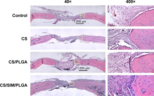 Figure 5 Histological specimens from calvarial defects after 12 weeks of implantation of bone graft substitutes with hematoxylin-eosin staining.Note: Calvarial defects implanted without bone graft substitutes were used as controls.Abbreviations: CS, calcium sulfate; SIM, simvastatin; PLGA, poly(lactic-co-glycolic acid) microspheres.