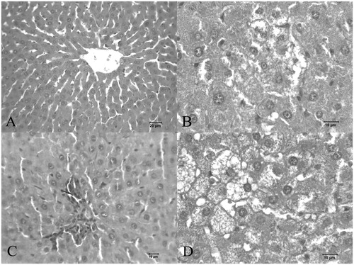 Figure 2. Histopathological changes: (A) control rat liver. (B, C, and D) Alcohol-treated rat liver.