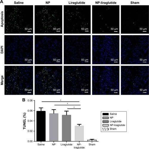 Figure 7 The liraglutide reduces cardiac cell apoptosis after MI.Notes: (A) Representative photomicrographs of TUNEL staining (green) and DAPI (blue) staining for the saline, NP, liraglutide, NP-liraglutide and sham groups in peri-infarct region. Scale bars, 50 µm. (B) Quantification of the percentage of TUNEL-positive nuclei. Data are shown as mean ± SEM, *P<0.05. NP-liraglutide: liraglutide loaded in PLGA–PEG NPs.Abbreviations: DAPI, 4-6-diamidino-2-phenylindole; MI, myocardial infarction; NP, nanoparticle; PEG, poly(ethylene glycol); PLGA, poly(lactic-co-glycolic acid); SEM, standard error of the mean; TUNEL, terminal deoxynucleotidyl transferase dUTP nick-end labeling.