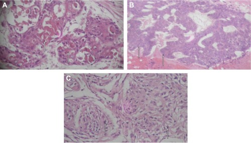 Figure 3 Histological examination (magnification ×40).