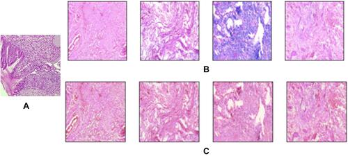 Figure 9 Effect of histogram matching on cervical histopathology sample images (A) Reference image (B) Source images (C) Histogram matched images.