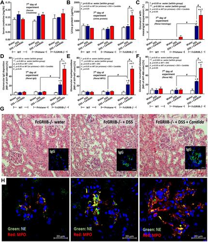 Figure 8 Characteristics of renal injury in FcGRIIB-/- mice after the administration of dextran sulfate solution (DSS) alone or with Candida gavage (DSS+Candida) as determined by serum creatinine (A), urine protein (B), glomerular injury (mesangial expansion) from the histology (C), immunoglobulin G (IgG) deposition in glomeruli (D) and glomerular neutrophil extracellular traps (NETs) as indicated by immunofluorescence of myeloperoxidase (MPO) (red color of Alexa Fluor 647) and neutrophil elastase (NE) (green color of Alexa Fluor 488) (E and F) are demonstrated (n = 6–9/group). Additionally, representative pictures of hematoxylin and eosin (H&E) stained section from kidney with immunofluorescence of glomerular IgG deposition (inset pictures) (G) and glomerular NETs formation (MPO and NE) (H) are demonstrated (original magnification 400x for H&E stain and 600x for immunofluorescence). Pictures from WT and Pristane mice are not presented due to the non-difference from FcGRIIB-/- mice with water control. *p < 0.05 vs water (within group); **p < 0.001 vs water (within group); ϕp < 0.05 vs WT+DSS; δp < 0.05 vs WT (or pristane) + DSS + Candida; #p < 0.05.