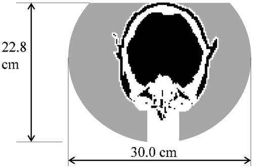 Figure 3. Bolus cross section.
