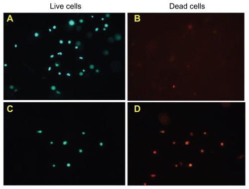 Figure 10 Fluorescent microscopy images of 20% nHA + B-SWCNT chitosan scaffold stained by calcein A and ethidium homodimer B for (A) live and (B) dead cells; Glass references stained for (C) live and (D) dead cells.