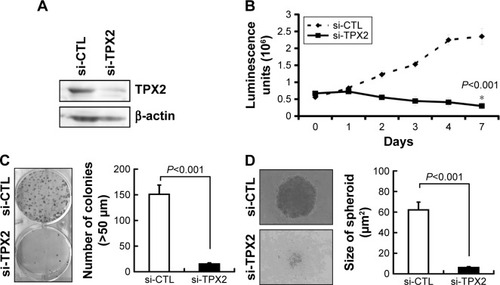 Figure 2 Inhibition of cell growth and reduction of tumorigenesis in human prostate cancer cell lines via TPX2 silencing.