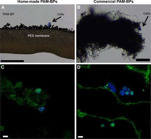 Figure 7 Cells grown on buckypapers.Notes: Hematoxylin/eosin staining of cells grown on (A) home-made BP (scale bar =200 μm) and (B) commercial BP (scale bar =25 μm). The commercial PAM-BP incubated with FAM-mir-503 and visualized by confocal microscopy after cell culture (C and D). The green bundles show the intricate network of CNTs forming the BP, whereas the green lines represent the irregular layers of BP. The nuclear staining indicates the presence of healthy cells, whereas the green spots within them indicate that these rigid bidimensional substrates are able to penetrate cells and deliver their nucleic acid cargo. (Scale bar =20 μm.)Abbreviations: BP, buckypaper; CNTs, carbon nanotubes.
