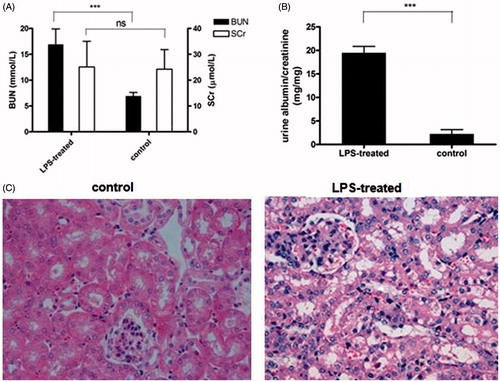 Figure 1. Induction of septic AKI mice with LPS treatment. (A) Serum urea and creatinine (SCr) were measured 24 h after LPS injection. Data shown as means ± SD of three independent experiments (p = 0.00071). Urine albumin to creatinine ratio was significantly increased in mice treated with LPS compared with healthy control mice. (19.51 ± 1.35 compared to 2.25 ± 0.9, p = 0.00067) (Upr/Ucr mg/mg). (C) Kidney sections was stained with PAS staining and checked under light microscope. Data shown here are one out of three independent experiments.