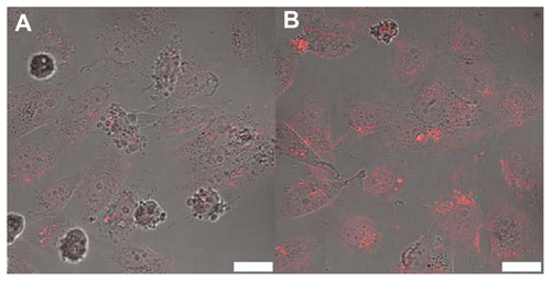 Figure S3 Confocal microscopy image of HepG2 cells treated with (A) SWNTDOX and (B) SWNT-HBA-DOX for 2 h, followed by further incubation for 24 h in fresh medium.Note: Scale bar: 25 μm.Abbreviations: SWNT, single-walled carbon nanotube; DOX, doxorubicin; HBA, hydrazinobenzoic acid.