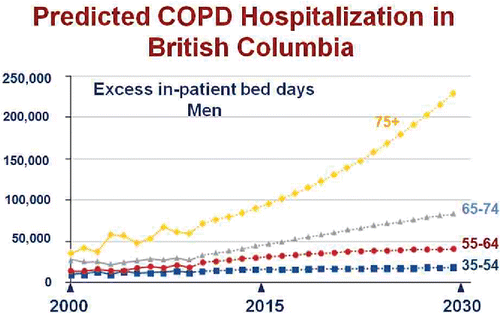 Figure 2. Actual (solid line) and projected (dotted line) in-patient hospitalization days for exacerbations of COPD in the Province of British Columbia between 2000 and 2030 stratified by age group. Adapted from Reference 2 and reprinted with permission of the American Thoracic Society. Copyright (c) 2017 American Thoracic Society. Khakban A, Sin DD, FitzGerald JM, McManus BM, Ng R, Hollander Z, Sadatsafavi M. The Projected Epidemic of Chronic Obstructive Pulmonary Disease Hospitalizations over the Next 15 Years. A Population-based Perspective. Am J Respir Crit Care Med. 2017 Feb 1;195(3):287–291. The American Journal of Respiratory and Critical Care Medicine is an official journal of the American Thoracic Society.