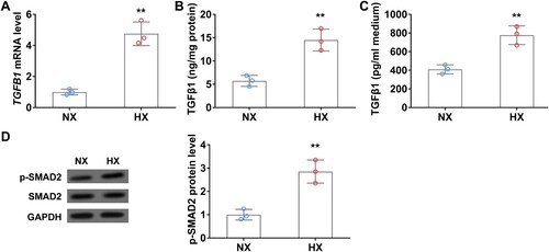 Figure 2. Hypoxia upregulates TGFβ1 levels in lung cancer cells in vitro. (A) The mRNA level of TGFβ1 in A549 cells under normoxia (NX) and hypoxia (HX) conditions for 24 h. B–C, The protein level of TGFβ1 in cell body (B) and culture medium (C) of A549 cells under normoxia (NX) and hypoxia (HX) condition for 24 h. (D) The protein level of p-SMAD2 in A549 cells under normoxia (NX) and hypoxia (HX) conditions for 24 h. n = 3 wells.