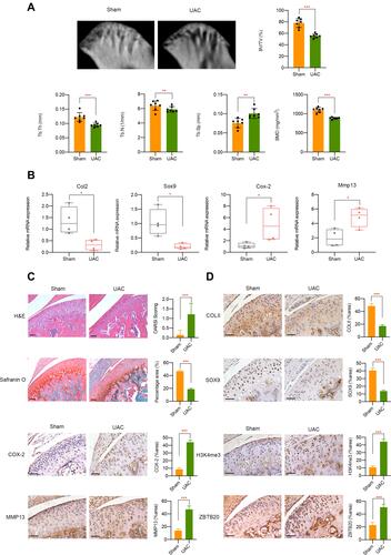 Figure 7 In vivo UAC mice model validation. (A) Micro-CT analysis of TMJ tissues from UAC group or sham controls. (B) mRNA level of Col2, Sox9, Cox-2, and Mmp13 in TMJ samples in different groups was determined by qPCR. (C) H&E and Safranin O fast green staining of TMJ tissues from healthy control and UAC mice. (D) Immunohistochemistry assay of TMJ tissues from healthy control and UAC mice. Scar bar, 50 μm. *p < 0.05, **p < 0.01, ***p < 0.001.