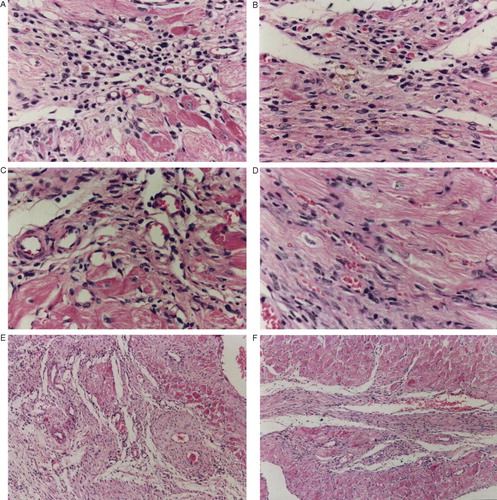 Figure 3.  A,B,C,D,E & F. Capillaries of L + V+A and L groups were identified and recognized by their size (<20 µm, Figure 3A,B; 20–40 µm, Figure 3C,D), a thin layer of endothelial cells and a lack of smooth muscle cells at a total magnification of 400×. Similarly, arterioles were identified and recognized by their size (>40 µm) and a thin layer of smooth muscle cells at a total magnification of 100×(Figure 3E,F).