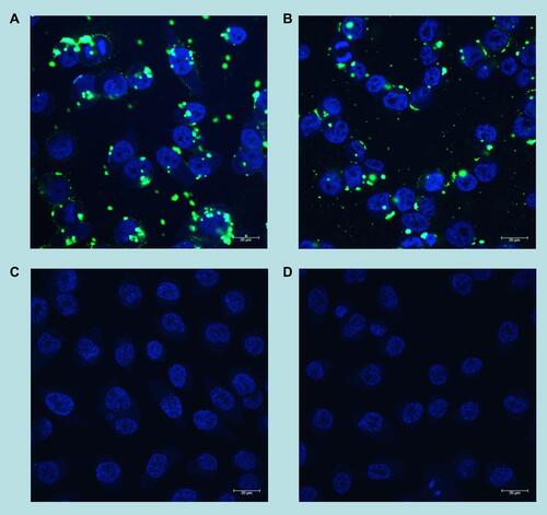 Figure 6 Confocal microscopy images of the cellular uptake of fluorescein-labelled DNA (2.5 μg per well), complexed with (A) AuNCs-DAB-Lf at weight ratio of 10:1, (B) DAB with weight ratio of 5:1, (C) free in solution after 24 h incubation with PC-3 cells ((D) untreated cells). Blue: nuclei stained with DAPI (excitation: 405 nm laser line; bandwidth: 415–491 nm), green: fluorescein-labelled DNA (excitation: 453 nm laser line; bandwidth: 550–620 nm) (magnification: ×63).