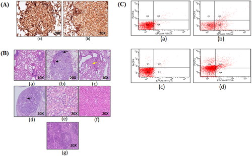 Figure 5. Immunohistochemistry and flow cytometric analysis of lung adenocarcinoma lesions. (A) Representative images of TTF-1+ lung tumor lesions at (a) 6 months latency period and (b) 10 months latency period. (B) Representative H&E lung tumor lesions of (a) control group; (b) untreated group; (c) free actinonin-treated group; (d) nanoformulated actinonin-treated group. H&E of other vital organs (e) kidney, (f) liver and (g) spleen. Black arrows indicate lymphocytic infiltration and yellow arrow indicate apoptosis.(C) The excised tumors screened for presence of EpCAM and CD45 positive cells. (a) Control EpCAM+, (b) Tumor EpCAM+, (c) Control CD45+, (d) Tumor CD45+.