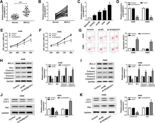 Figure 1 KCNQ1OT1 knockdown repressed proliferation and autophagy and induced apoptosis in NSCLC. (A, B) KCNQ1OT1 expression in 35 pairs of NSCLC tumor tissues and normal tissues. (C) KCNQ1OT1 expression in NSCLC cell lines (HCC827, H1299, A549, H460) and human bronchial epithelial cell BEAS-2B. (D–K) A549 and H460 cells were stably transfected with sh-KCNQ1OT1 or sh-NC. (D) KCNQ1OT1 expression in stably transfected A549 and H460 cells. (E, F) Cell viability of transfected A549 (E) and H460 cells (F). (G) Cell apoptosis of transfected A549 and H460 cells. (H, I) The expression of apoptosis-related protein cleaved caspase-3, cleaved caspase-9, Bax and anti-apoptosis protein BCL-2 in transfected A549 (H) and H460 cells (I). (J, K) Protein expression of autophagy markers LC3 and P62 in transfected A549 (J) and H460 cells (K). *P<0.05, ***P<0.001.