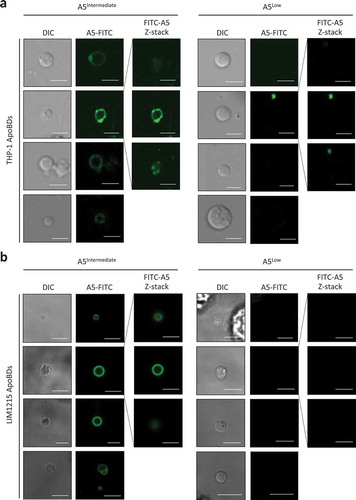 Figure 2. Phosphatidylserine exposure on ApoBDs is a spectrum. A5-FITC staining of phosphatidylserine (PtdSer) on ApoBDs generated from THP-1 (a) and LIM1215 (b) cells, as determined by confocal microscopy. A selection A5Intermediate and A5Low ApoBDs are shown. Selected ApoBDs are displayed as z-stack images to show the distribution of A5-FITC staining on ApoBDs. Scale bar, 5 μm. Data are representative of at least three independent experiments.