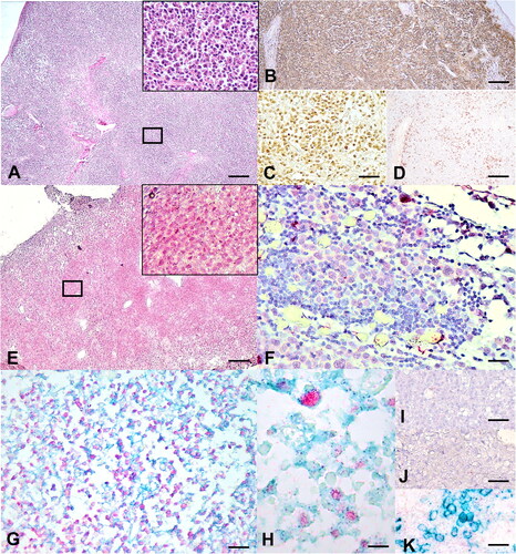 Figure 1. Histopathological features of DCH infection in lymphoma tissue of cats. (A, E-J) Sections from case no. 3. (A) The lymphoid follicles are diffusely expanded by large neoplastic lymphocytes separating coarse fibrovascular stroma. Neoplastic lymphocytes have moderate amounts of cytoplasm with distinct cellular borders. The nuclei are 2 times larger than red blood cells, round, and finely stippled, containing a prominent nucleolus (square box is indicated for the inset). (B-D) DCH qPCR-positive lymphoma section of case no.6. (B) Diffuse, generalized cytoplasmic IHC staining for CD79. (C) Prominent nuclear IHC staining for pax-5 in multiple neoplastic cells. (D) Cytoplasmic IHC staining for CD3 in some single cells in lymphoma tissue. (E) In situ hybridization (ISH) for DCH DNA staining (red precipitates) in lymphoma tissue revealed intensely intranuclear staining in diffuse round cells (square box is indicated for the inset). (F) Prominent nuclear staining for DCH hybridization in large, pleomorphic round cells. No DCH labeling was observed within the small round cells. (G) Dual DCH ISH (red precipitates) and CD79 IHC (green color) revealed marked, diffuse staining in the nucleus and cytoplasm of neoplastic cells, respectively. (H) Higher magnification reveals intense DCH labeling (red precipitates) in the nucleus of the cells that were cytoplasmically stained with CD79 IHC (green color). (I) Negative control using unrelated probe. No hybridization signals were present in the DCH qPCR-positive lymphoma section that was incubated with the FBoV-3 ISH probe. (J) Negative control using DNase-treated section. No hybridization was present in the DCH qPCR-positive lymphoma section treated with DNase prior to incubation with the DCH probe. (K) Negative control for dual ISH/IHC labeling. Cytoplasmic IHC CD79 staining of the DCH qPCR-positive lymphoma section incubated with the FBoV-3 probe. Bars indicate 180 µm for A, B, D and E; 80 µm for F; 120 µm for C, G, I, and J; and 20 µm for H and K.