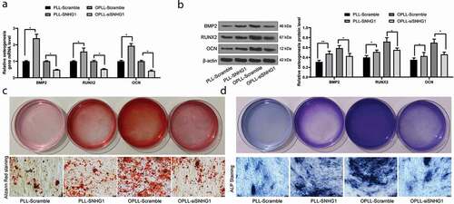 Figure 2. Silencing of SNHG1 inhibits the osteogenic differentiation of LFCs. A-B, mRNA (a) and protein (b) expression of osteogenesis-related factors BMP-2, RUNX2 and OCN determined by QRT-PCR and western blot analysis, respectively; C-D, the osteogenic properties of LFCs determined by alizarin red staining (c) and ALP (d) staining. The data are expressed as the mean ± SD. Two-way ANOVA and Tukey’s multiple comparison test was used to determine statistical significance; *, p < 0.05
