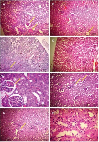 Figure 3 Histological features of mice kidney after treatment with compounds I, II or diclofenac for 7 and 30 days.Notes: (A) Kidney of mice taking compound I for 7 days showing hemorrhage and retraction of glomerular tuft (arrows); (B) kidney of mice taking compound II for 7 days showing some retraction of glomerular tuft (arrow); (C) kidney of mice that received diclofenac for 7 days showing tubular destruction, hemorrhage and necrosis (arrow); (D) kidney of the control after 7 days; (E) kidney of mice taking compound I for 30 days showing hemorrhage, retraction of glomerular tuft, loss of brush border integrity and thickened basement membrane (arrow); (F) kidney of mice taking compound II for 30 days showing hemorrhage, retraction of glomerular tuft, loss of brush border, cast formation and necrosis (arrows); (G) kidney of diclofenac receiving mice for 30 days showing loss of bundle brush border and casts in tubules (arrow); (H) control kidney after 30 days. Photos were taken at 40× magnification.