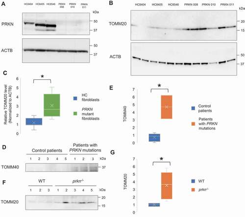 Figure 4. Increased extracellular mitochondrial protein in the fibroblasts and CSF derived from PD patient with PRKN mutations and the sera from PRKN-deficient mice. (A) Representative western blot image of PRKN protein expression in primary skin fibroblasts of healthy control subjects (HC8404, HC8405, HC8546) and PD patients with PRKN mutations (PRKN 008, 010, 011). PRKN levels were undetectable in patient-derived PRKN mutant fibroblasts. (B and C) Western blotting and densitometry analysis showing increased level of extracellular mitochondrial protein TOMM20 relative to ACTB in patient-derived PRKN mutant fibroblasts. Mann Whitney Test, n = 3 for each group, * p < 0.05. (D and E) Western blotting and densitometry analysis showing increased level of mitochondrial protein TOMM40 in the CSF of patients with PRKN mutations. Mann Whitney Test, n = 5 for control group and n = 3 for patients with PRKN mutations group, * p < 0.05. (F and G) Western blotting and densitometry analysis showing increased level of mitochondrial protein TOMM20 in the sera of prkn−/- mice. Mann Whitney Test, n = 3 for WT group and n = 5 for prkn−/- group, * p < 0.05