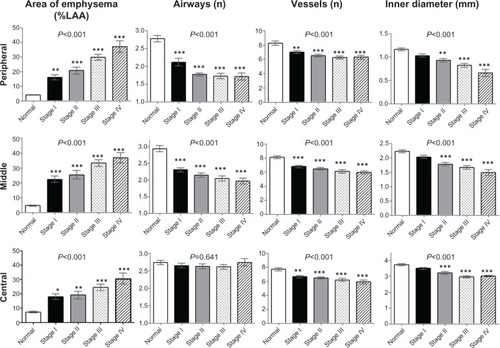 Figure 6 Percentage of low attenuation area, number of airways, number of vessels and airway inner diameter in patients with chronic obstructive pulmonary disease grouped by GOLD stage and compared with controls. Bar graphs show summaries of lung structures in the 3 cm circle around the selected bronchus measured in right B1 to B10 bronchi. Means and standard error bars are shown. The peripheral zone was defined as the point 2 cm from the pleura; the central zone was defined as the point 2 cm from the entrance to the segmental bronchus; the middle zone was designated as the point half-way between the peripheral and central zone. Analysis of variance was used to determine the overall difference among groups, and the Tukey–Kramer multiple comparison test was used to compare groups. Significances between the controls (normal) and each GOLD airflow limitation stage (I–IV) are shown. Asterisks indicate *P<0.05, **P<0.01, and ***P<0.001 compared with controls.