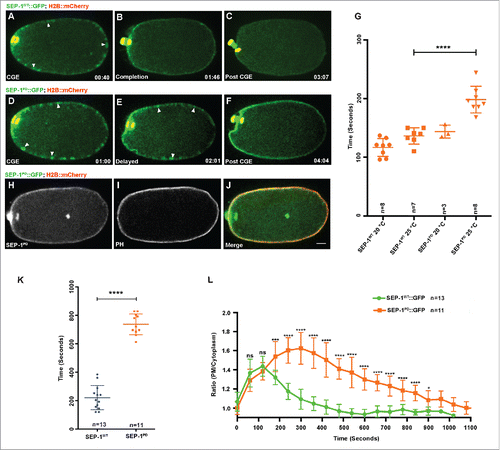 Figure 7. SEP-1PD::GFP expression delays cortical granule exocytosis. (A-F) Representative images of separase localization during anaphase I. Localization of SEP-1WT::GFP (A, green) and SEP-1PD::GFP (D, green) to cortical granules indicated by white arrowheads (H2B::mCherry in red). CGE was delayed in homozygous SEP-1PD::GFP (E) compared with SEP-1WT::GFP (B) during late anaphase I. (F) SEP-1PD::GFP associated with the cortex for a longer time after CGE compared with SEP-1WT::GFP (C). (G) Quantification of anaphase onset to completion of CGE. SEP-1PD::GFP embryos take longer to finish CGE than SEP-1WT::GFP. (H-J) Colocalization of SEP-1PD::GFP (green) with PH::Cherry (red) at the plasma membrane after CGE. (K) Average time that SEP-1WT::GFP or SEP-1PD::GFP remains associated with the plasma membrane after CGE. (L) Ratio of plasma membrane to cytoplasmic SEP-1PD::GFP and SEP-1WT::GFP after onset of anaphase I. Scale Bars, 10 μm. P-values: * = <0.05; *** = <0.001; **** = <0.0001; ns = not significant (t-test). Error bars indicated standard error of the mean.