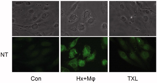 Figure 6. TXL inhibited nitrotyrosine formation to attenuate HCMEC injury (400×). The nitrotyrosine content was evaluated by immunofluorescence. The upper ones were HCMEC morphological alterations and the lower showed nitrotyrosine fluorescence. Con, control; Hx + Mϕ, hypoxia plus macrophage co-culture; MT, middle dose TXL.