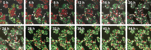 Figure 4. Time-lapse imaging of FUCCI-expressing HeLa cells treated with rMETase being trapped in S/G2 phase. After seeding on 35 mm glass dishes and culture over night, FUCCI-expressing HeLa cells were treated with rMETase at a dose of 1.0 unit/ml. The cells in G0/G1, S or G2/M phases appear red, yellow or green, respectively. These results show that rMETase treatment traps cancer cells in S/G2, a chemo-sensitive phase of the cell-cycle. Scale bar: 50 μm.