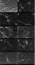 Figure 5 SEM micrographs of rat BMSCs cells attachment on the surfaces of Cu-doped n-CDHA/MAC composite scaffolds after 1 days (A, C, E, G, I) and 4 days (B, D, F, H, J) of culture. (A and B), 0% Cu-doped n-CDHA/MAC; (C and D), 0.5% Cu-doped n-CDHA/MAC; (E and F), 1% Cu-doped n-CDHA/MAC; (G and H), 2% Cu-doped n-CDHA/MAC; (I and J), 5% Cu-doped n-CDHA/MAC.Abbreviations: n-CDHA/MAC, nano calcium-defcient hydroxyapatite/multi(amino acid) copolymer; SEM, scanning electron microscopy; BMSCs, bone marrow stromal cells.
