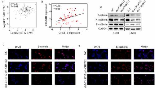 Figure 6. Knockdown of CHST12 inhibited the activation of WNT/β-catenin pathway. (a-b) The co-expression relationship between CHST12 and CTNNB1 in our GBM tissues and TCGA GBM tissues. (c) The expression of β-catenin, E-cadherin, and N-cadherin in the negative control group and CHST12 knockdown groups. (d–e) Immunofluorescent staining detected the expression of β-catenin and E-cadherin in the negative control group and CHST12 knockdown groups. The white lines indicate a measurement of 50 μm