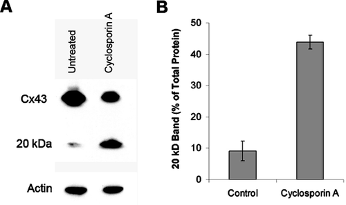 Figure 7 The production of the 20-kDa fragment of Cx43 may be regulated in some cells. Western blot analysis of Cx43-imunoreactive proteins expressed in CHO cells that were either maintained in control conditions (untreated) or stimulated with 50 μ g/mL cyclosporin A overnight. Panel A shows an example of the results and panel B depicts a plot summarizing the cumulative results. Notice the increase in the density of the 20-kDa band and the decrease in the density of the band corresponding to the 43-kD protein. For the data in panel B, the density of the 20-kDa band was measured relative to the total amount of Cx43-immunoreactive protein. Actin was used as a loading control. The results suggest that the amount of the 20-kDa CT fragment of Cx43 that is present in the cells can be regulated by exogenous factors.