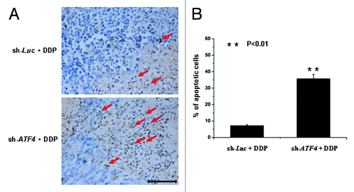 Figure 6. ATF4 protects HCC cells from apoptosis induced by cisplatin in xenograft models. (A) Tumors from xenograft models were sectioned and stained with immunohistochemistry using a TUNEL assay kit. Representative areas are shown in the figure. Scale bar equals 100 μm. (B) The ratio of TUNEL-positive cells to total cells were expressed as percentage. Data are shown as the mean ± SD from the calculation of five random fields at × 400 magnification. **p < 0.01.