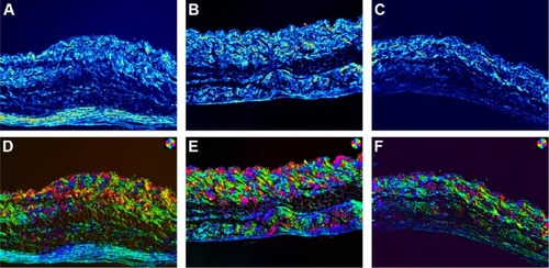 Figure 14 Polarized light microscopic pictures of skins.Notes: Birefringent structures in unstained skins. (A) Untreated skin; (B) skin treated with ethosomal cataplasm; (C) skin treated with conventional cataplasm. Orientation (independent polarization) pseudocolor microphotographs (100×) of unstained skin: (D) untreated skin; (E) skin treated with ethosomal cataplasm; (F) skin treated with conventional cataplasm. The magnifications of (A–F) are all 100×.