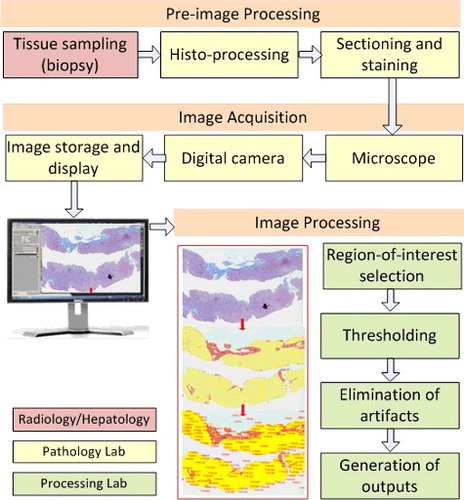 Figure 1. Digital image analysis process starting from biopsy to quantification of final results.