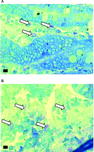 Figure 5 Histological examination of mast cells using toluidine blue stain at a magnification of 1000X (marker bar = 5 μm). Mast cells are stained purple (some are indicated by arrows). A- Control, B-Cold stressed.